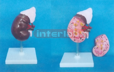 MIDDLE KIDNEY WITH ADRENAL GLAND (2 PARTS) MAGNIFIED ON BASE 14.5 cm LONG